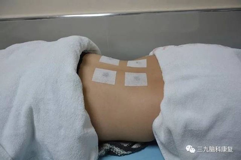 中药面膜,一种天然护肤的新兴选择?今天我们就来详细解读一下。
